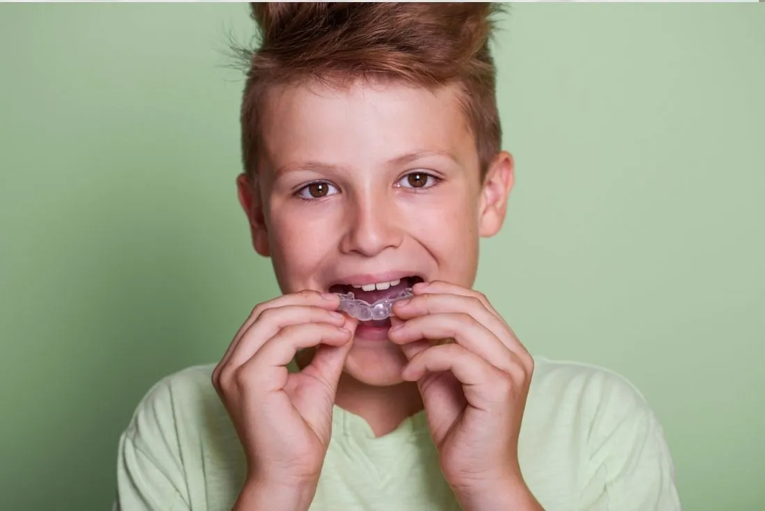 Custom night guards and mouth guards at FLOSS Dental - Delray